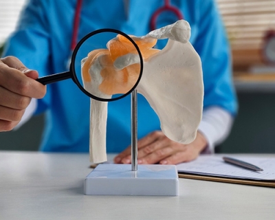 Shoulder Labral Tear Surgery in Los Angeles: Symptoms, Treatment, Recovery, and Results